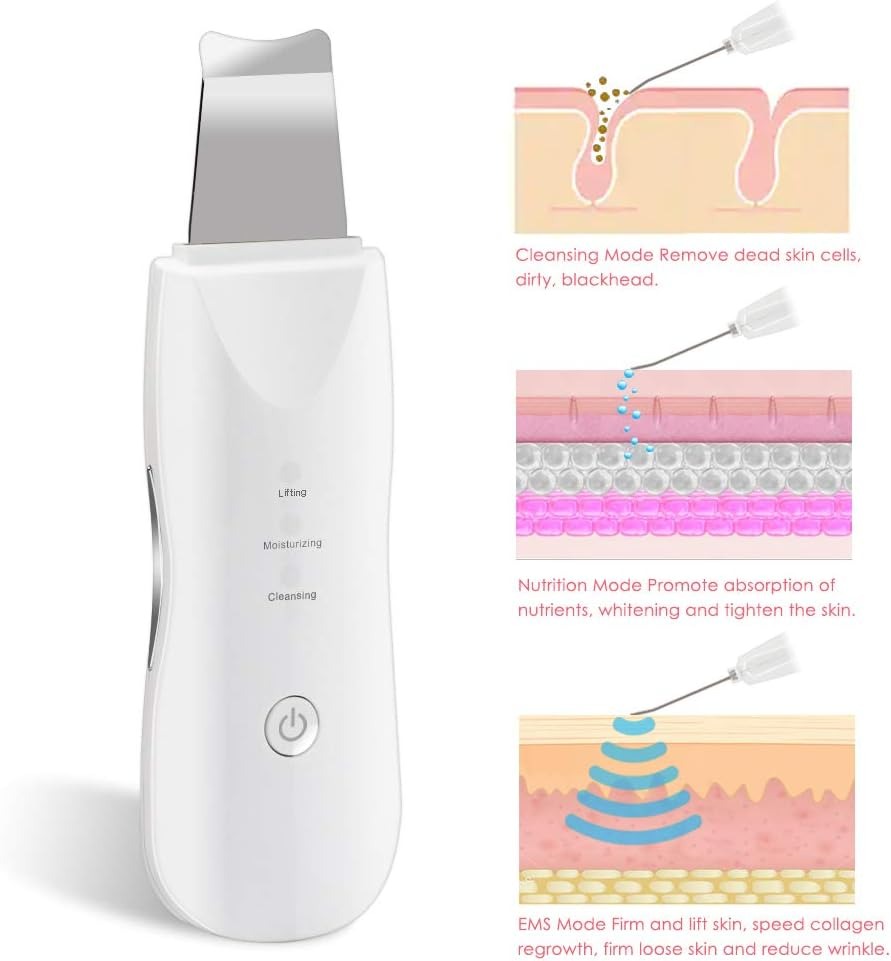 Electric blackhead pore remover